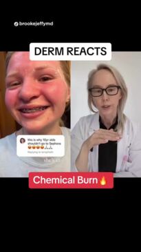 10 yr suffers chemical burns after shopping at Sephora and buying TikTok viral items