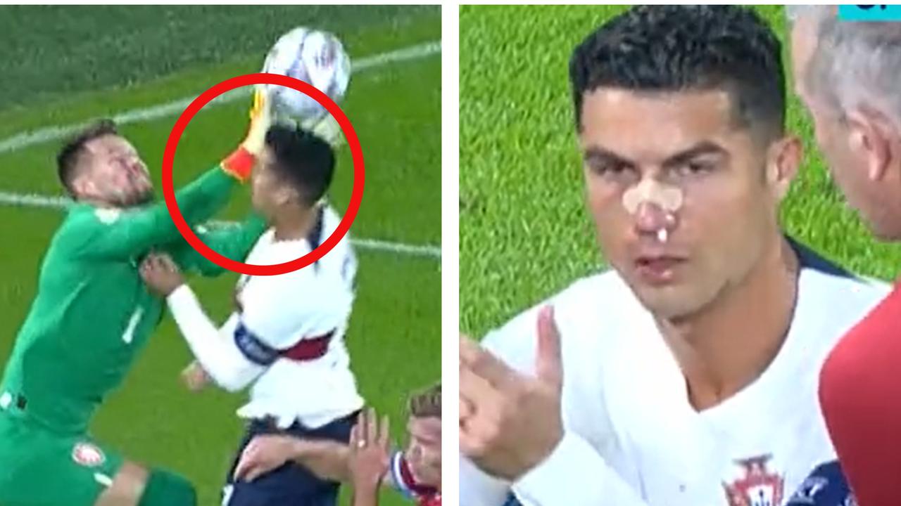 Cristiano Ronaldo took a big whack to the face. Picture: Supplied