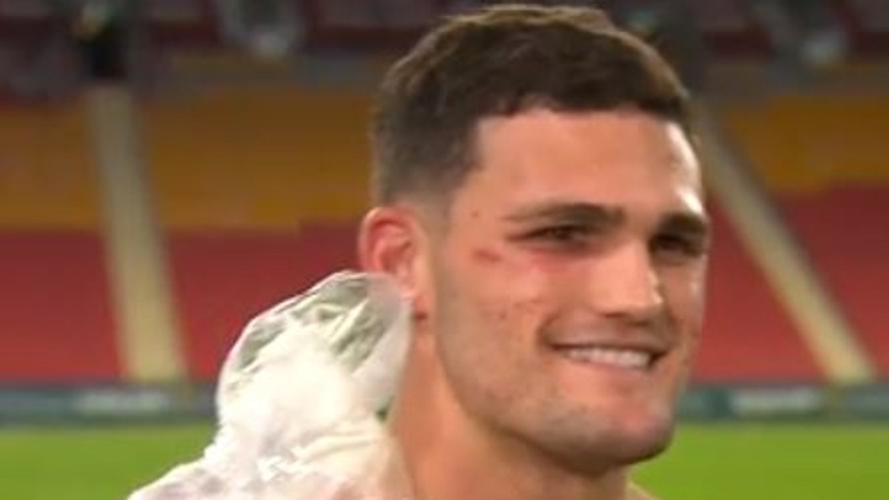 Nathan Cleary with shoulder iced in post-match Origin II presser