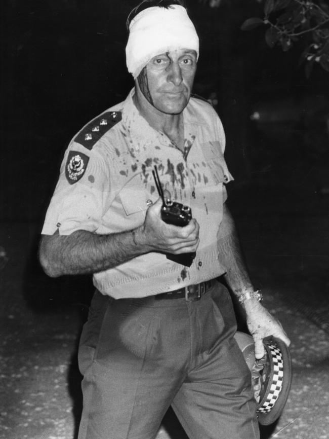 A bandaged Inspector Nick Zuvich directs police operations during the 1984 Glenelg riot.