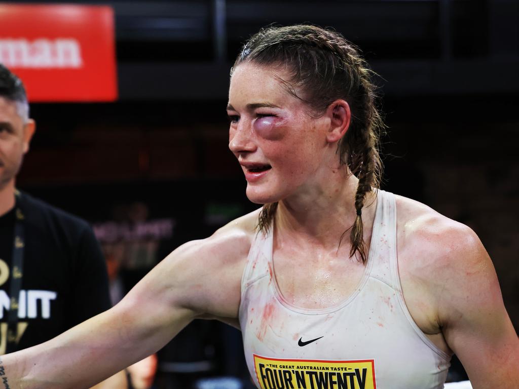 Boxing legends Johhny Lewis and Jeff Fenech believe Tayla Harris’ fight should have been called off after this ugly injury. Picture: Getty Images.