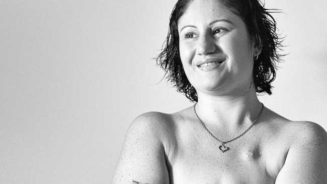 Seeing Mastectomy Scars The Worst Day Of My Life The Courier Mail