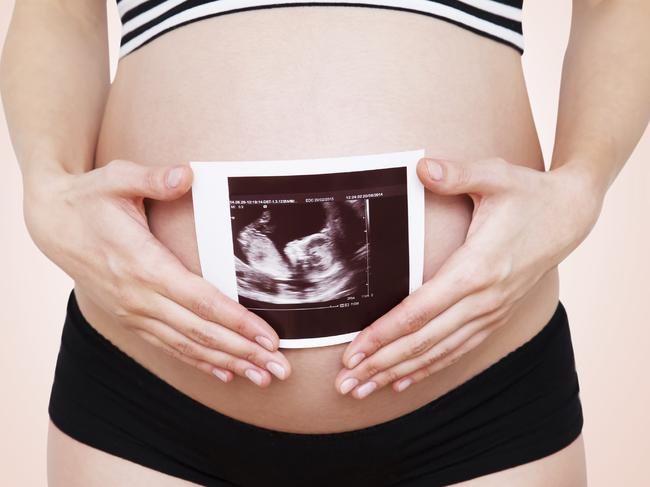 Generic photo illustrating IVF. Picture: iStock
