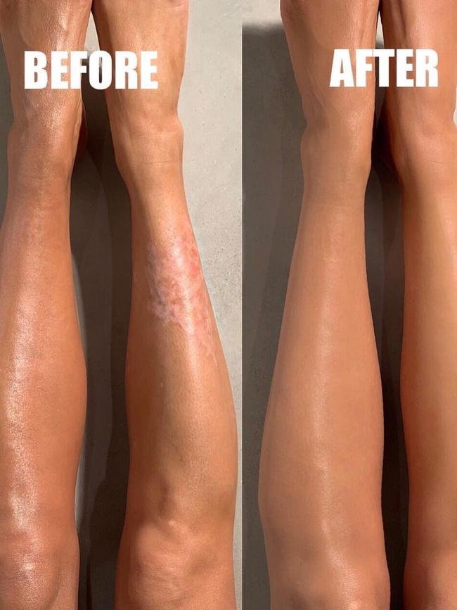 Kim Kardashian also shared this body foundation before and after.