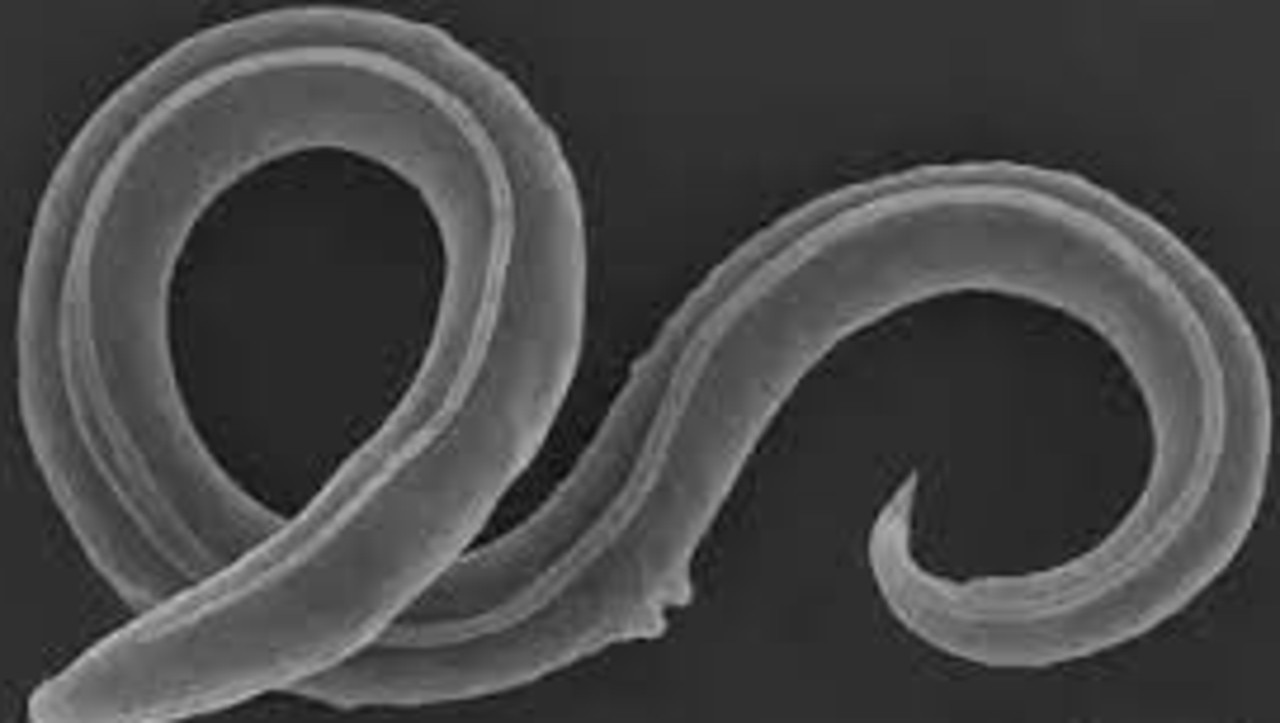 The ancient roundworm found frozen in the Siberian permafrost and revived after 46,000 years. Picture: supplied