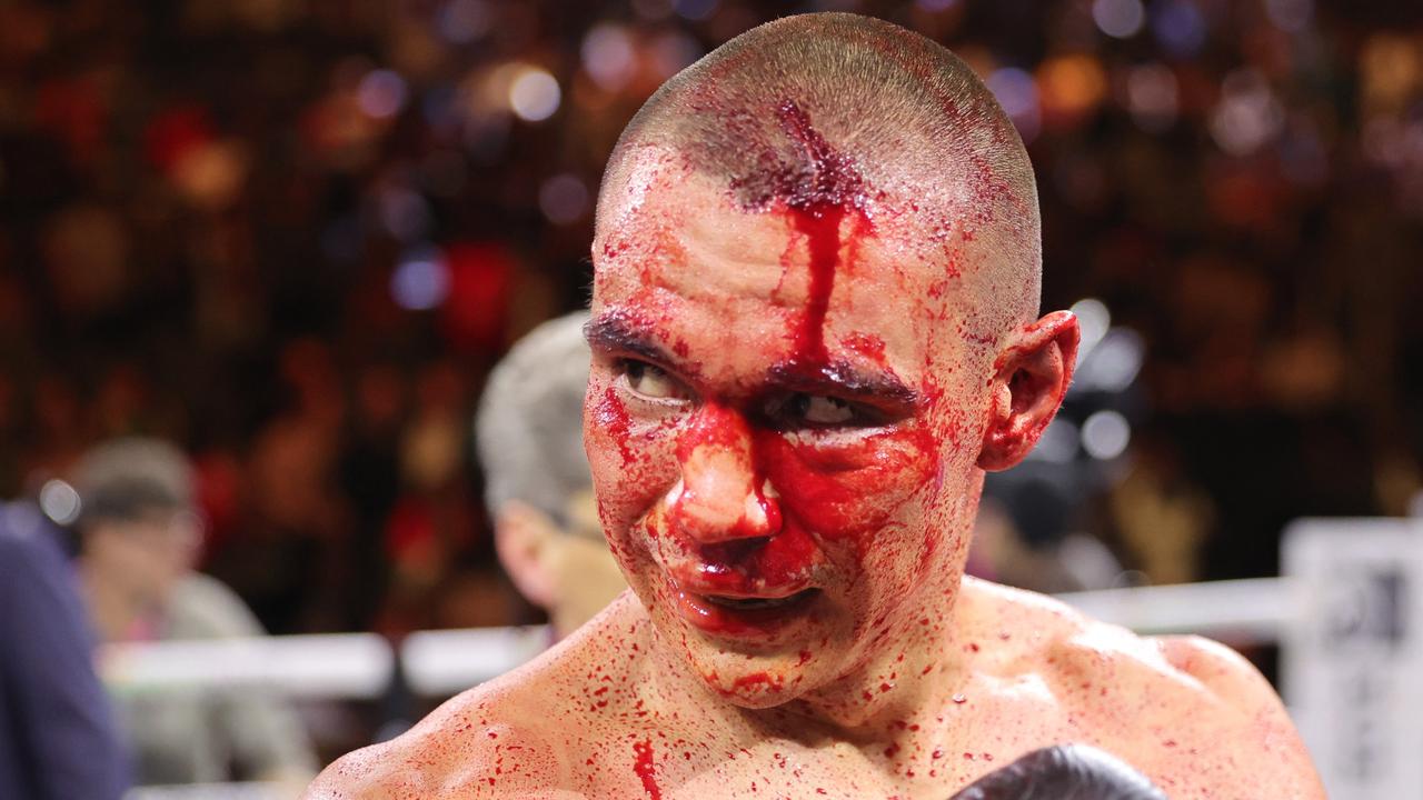 Tszyu fought while being blinded by his own blood. (Photo by Steve Marcus/Getty Images)