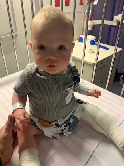 Baby Lewis recovering after surgery. Picture: Supplied.