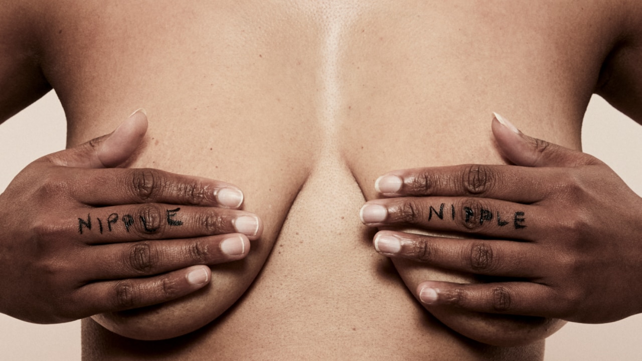 Are Your Nipples Sad?: A Discussion of Sad Nipple Syndrome