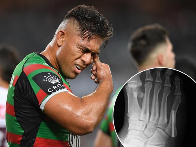 ‘I was losing my mind’: NRL star who had to learn to walk again