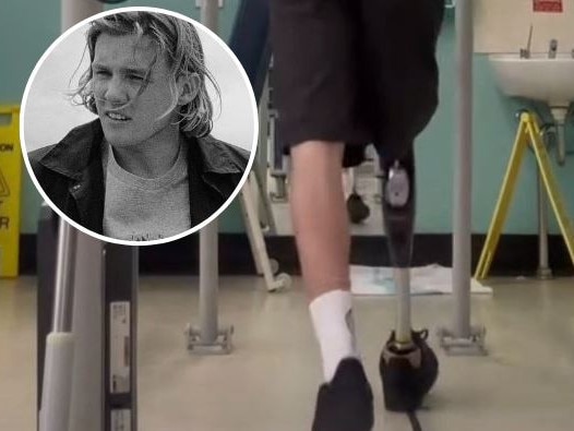 Mid-North Coast shark attack victim Kai McKenzie testing out his new artificial leg.