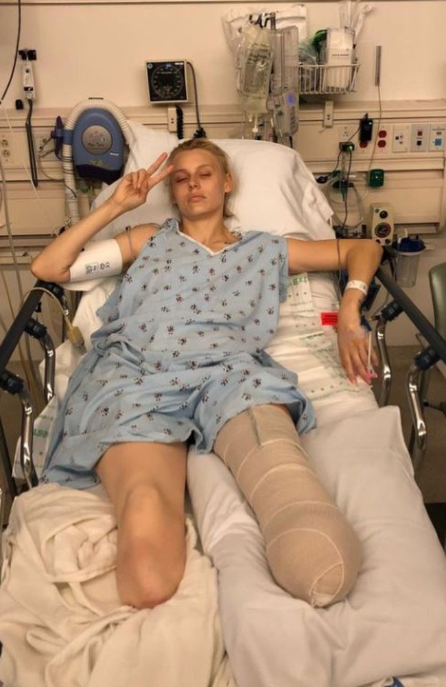 She lost both of her legs due to Toxic Shock Syndrome. Picture: Instagram / @theimpossiblemuse