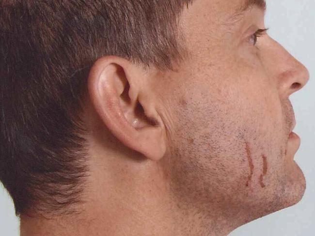 Gerard Baden-Clay told the court the scratches on his face were caused by an old razor