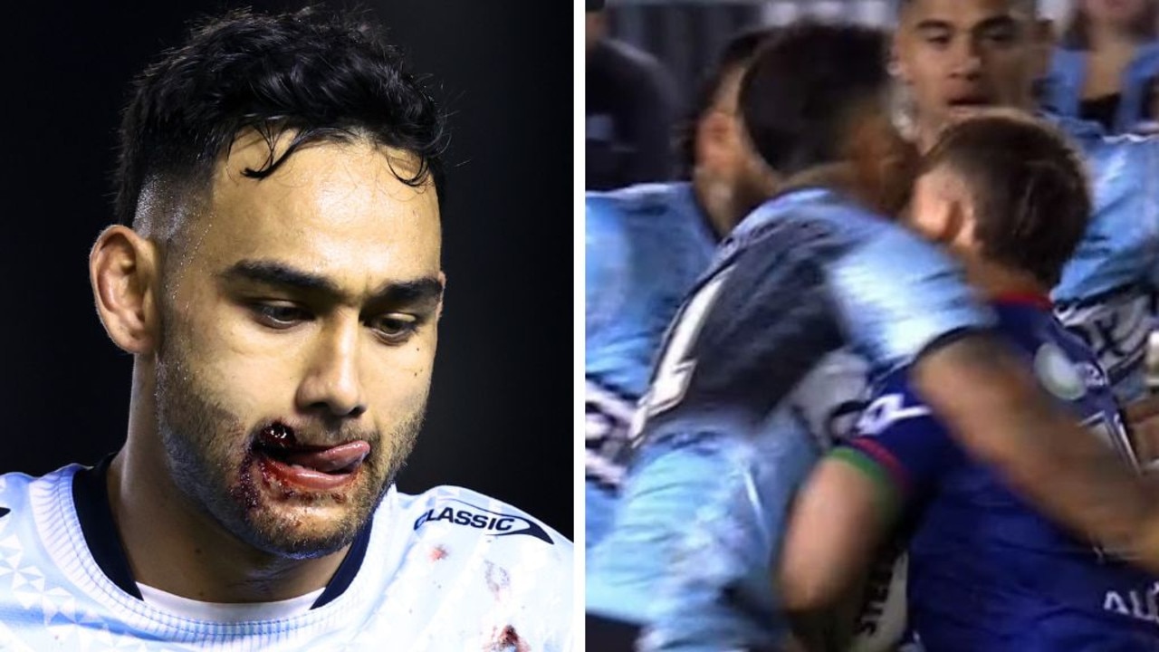 Sickening injury after horror head clash