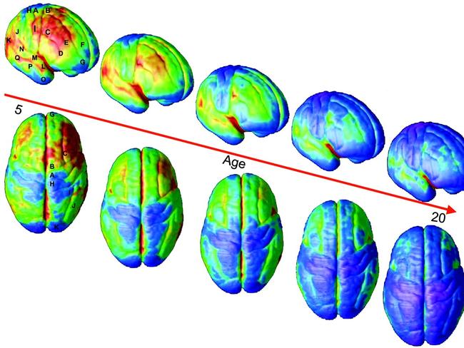 Right lateral and top views of the dynamic sequence of GM maturation over the cortical surface. The side bar shows a color representation in units of GM volume. The initial frames depict regions of interest in the cortex Dynamic mapping of human cortical development during childhood through early adulthood. Picture: Supplied/ PNAS