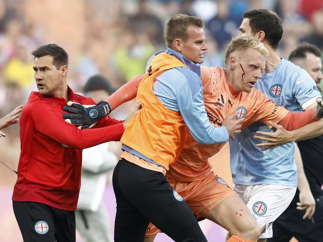 *APAC Sports Pictures of the Week - 2022, December 19* - MELBOURNE, AUSTRALIA - DECEMBER 17: A bleeding Tom Glover of Melbourne City is escorted from the pitch by team mates after fans stormed the pitch during the round eight A-League Men's match between Melbourne City and Melbourne Victory at AAMI Park, on December 17, 2022, in Melbourne, Australia. (Photo by Darrian Traynor/Getty Images)