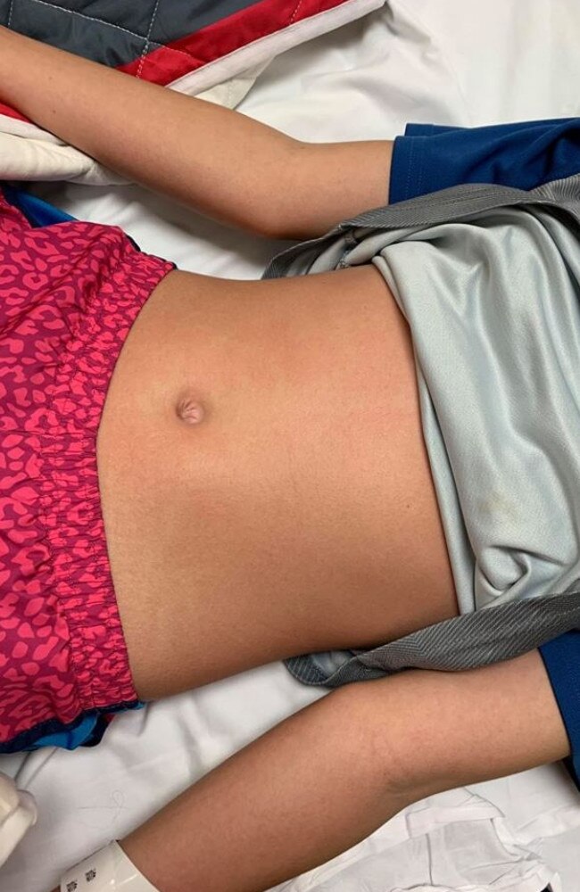 The 12-year-old was admitted to a paediatric intensive care unit. Picture: Michelle Hill