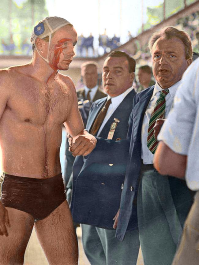 Ervin Zador of Hungary injured in the water polo match against the Russian team at the Olympic pool.