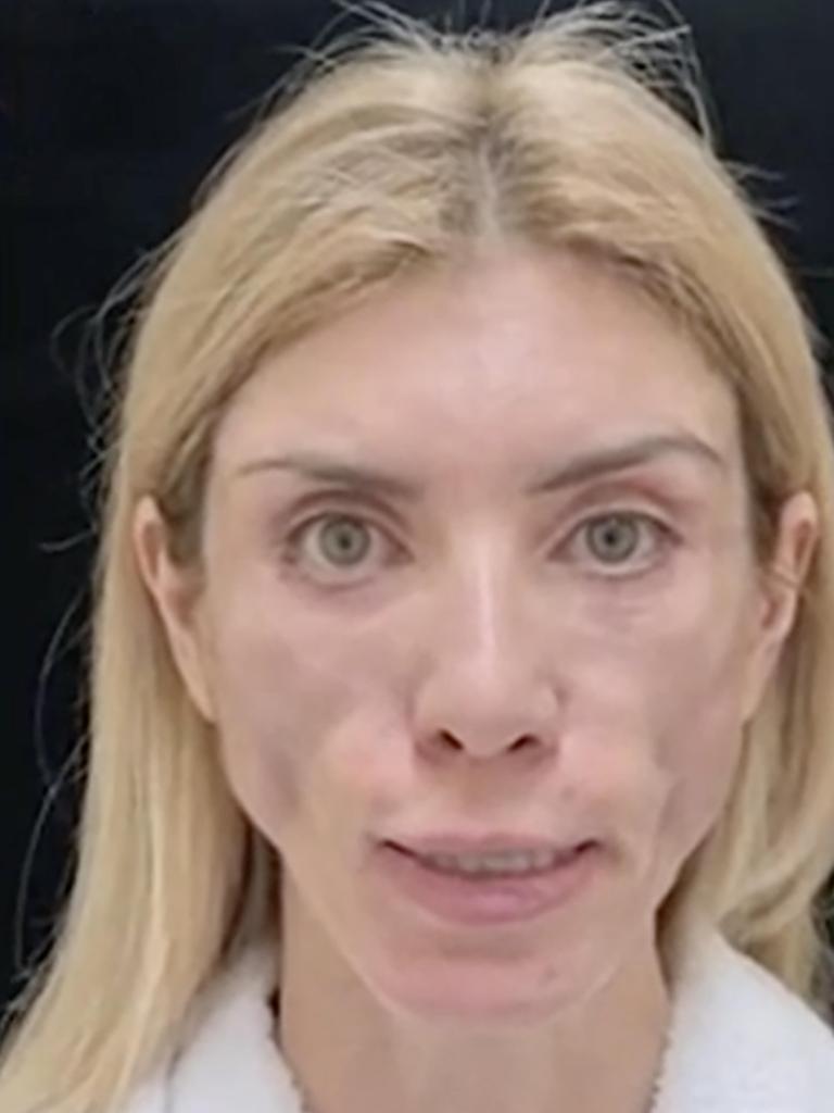 The former Russian beauty queen claims the surgery ‘left her unable to close her eyes’. Picture: East2West News
