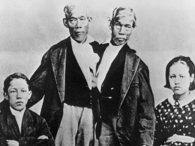 The most famous Siamese twins, Chang and Eng Bunker with their wives, who were sisters, circa 1865.