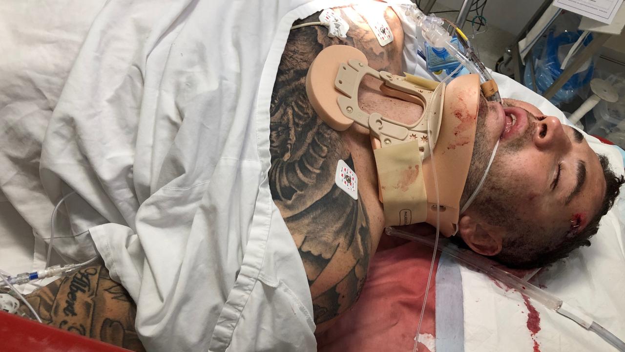 Manly Sea Eagles NRL star Joel Thompson ended up in hospital after suffering a head injury while drinking. Picture supplied