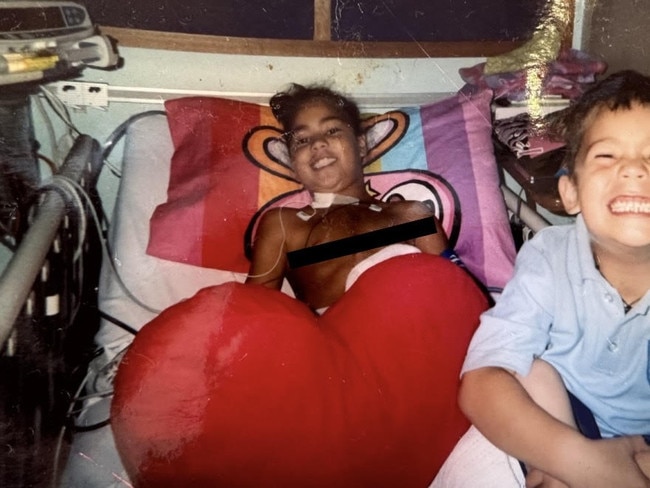 Kennedy Cherrington, aged eight, recovers after her open heart surgery, pictured here with brother Winniata Cherrington.