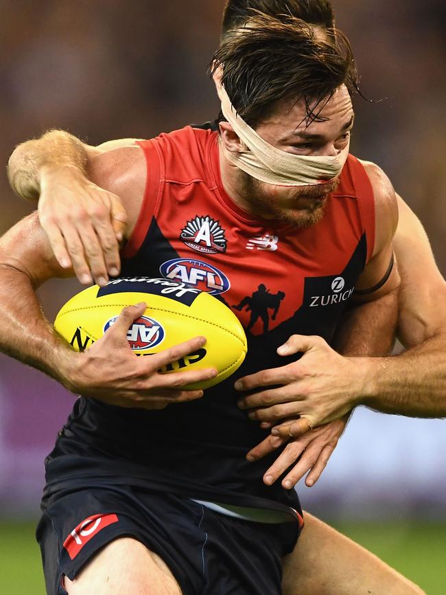 Hibberd shows the effects of his fall. Picture: Getty Images