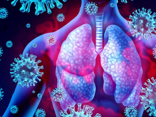 Lung virus infection and coronavirus outbreak or viral pneumonia and coronaviruses influenza as a dangerous flu strain cases as a pandemic medical health risk concept with disease cells with 3D render elements.