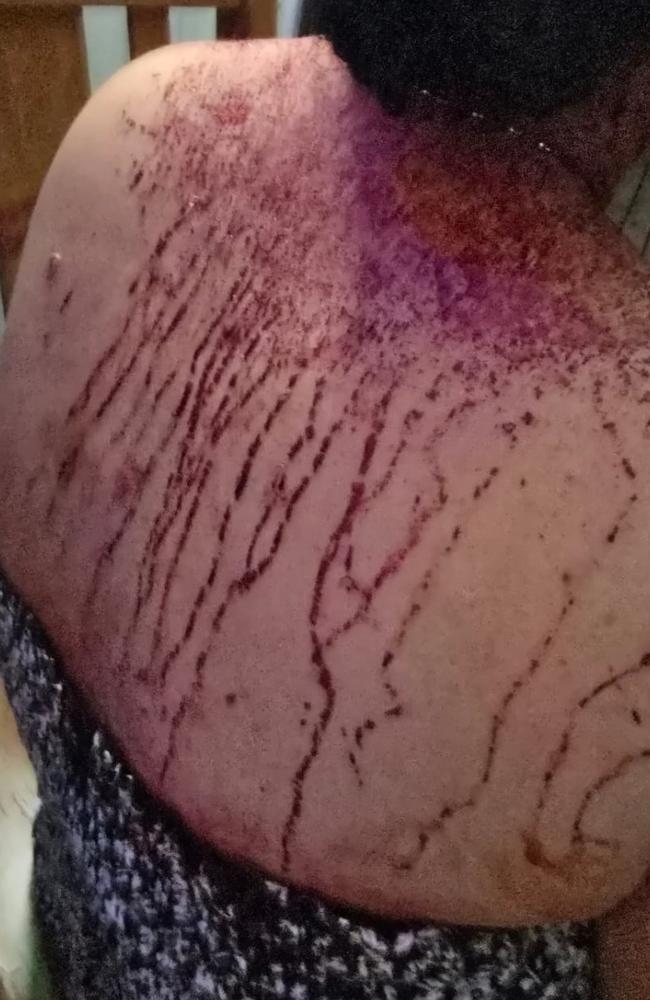 A resident who tried to break up a fight was glassed from behind for her trouble.