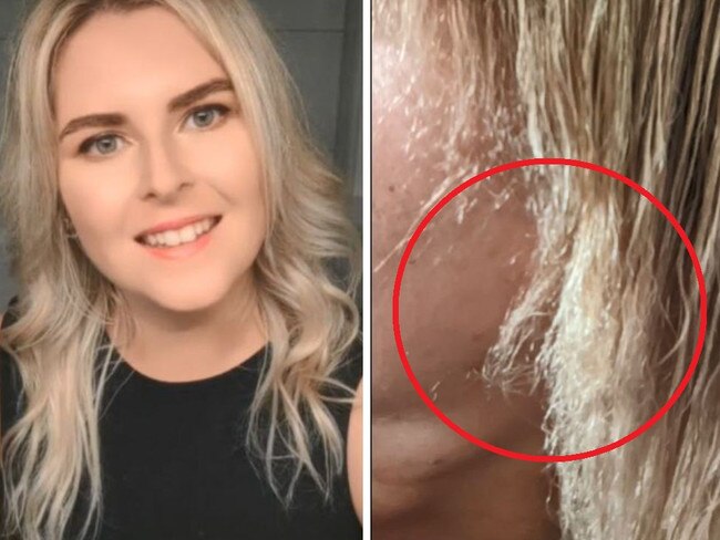 The woman lost half her hair after the treatment. Picture: TikTok