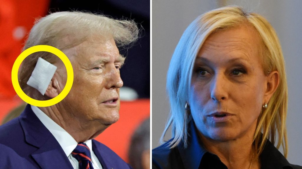 Tennis icon says Donald Trump’s ear bandage was a ‘PR stunt’