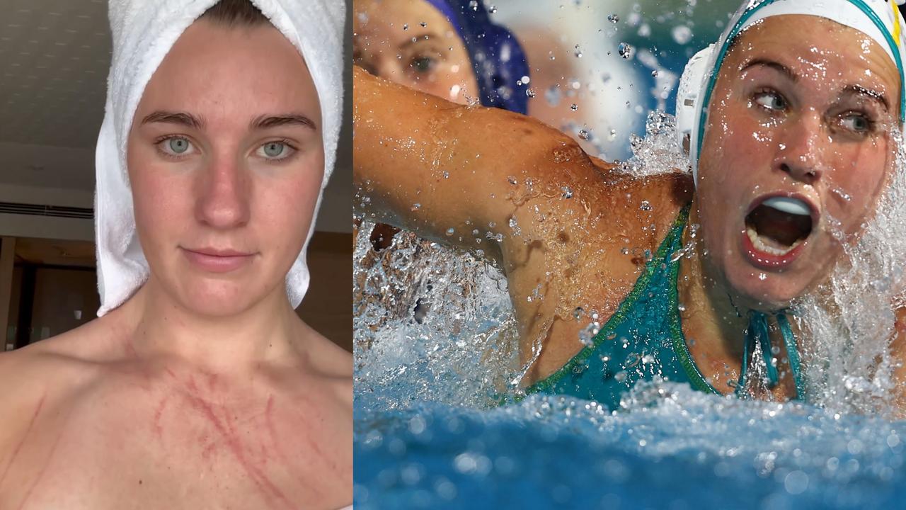Australian water polo star reveals scratch wounds after Stingers defeat  China at world champs
