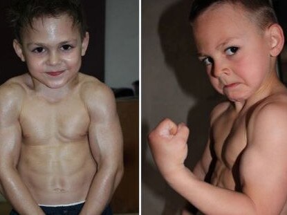 World’s strongest boy now unrecognisable