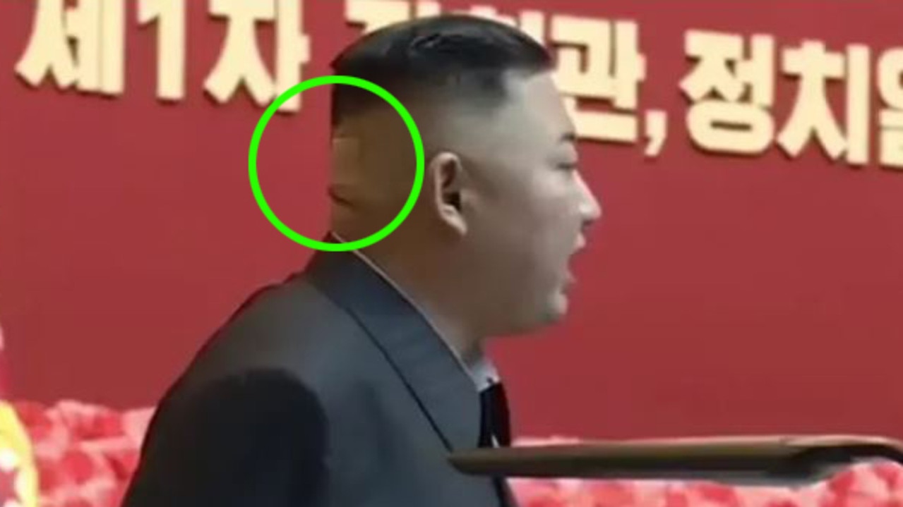 The mysterious patch on Kim Jong-un’s head. Picture: Pyongyang Broadcast Service