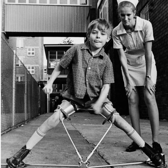 A nurse with Batemans Bay boy Owen, who had Perthes Disease, and was the first Royal Far West child to wear a newly developed "Toronto" splint.