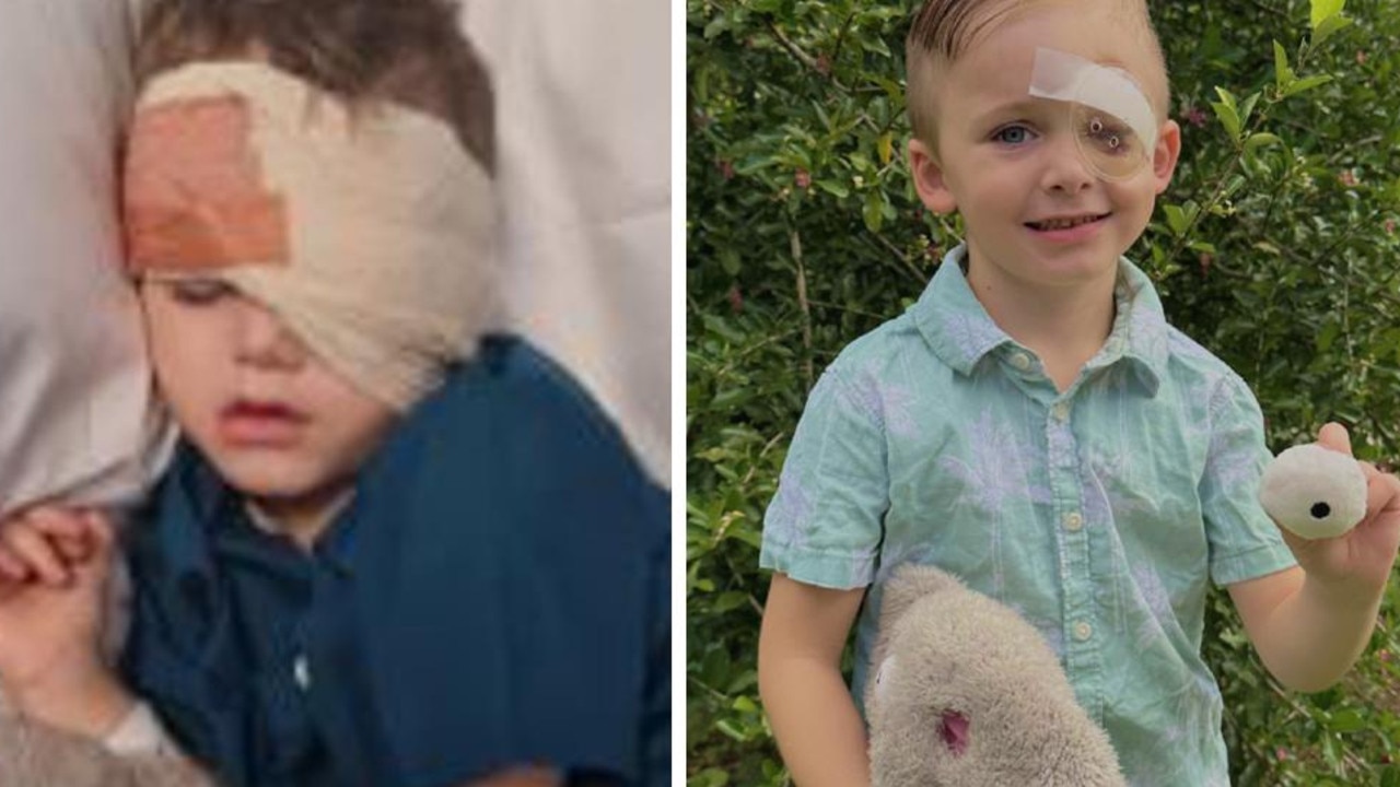 ‘My boy’s cancerous eye was removed, these are the changes we saw’