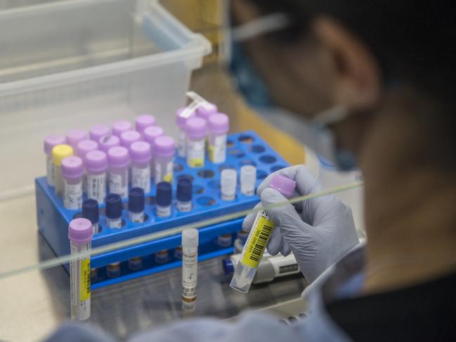 GOSFORD, AUSTRALIA - News Local Photos NOVEMBER 26, 2020. A lab scientist prepares COVID-19 test samples for the new BD MAX test machine at the NSW Health Pathology Gosford lab. Gosford Hospital is now carrying out COVID-19 diagnostic testing so Central Coast residents get their COVID-19 results a lot quicker. Picture: News Local / Troy Snook