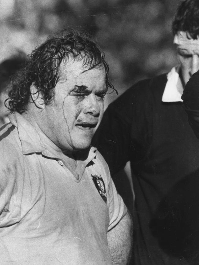 Chris Handy wears his bloodied head as a badge of honour during the match at the SCG.