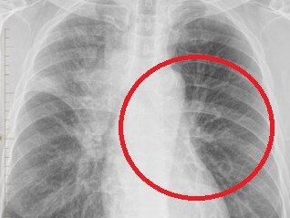‘Sat in shock’: X-ray reveals tourist’s horror
