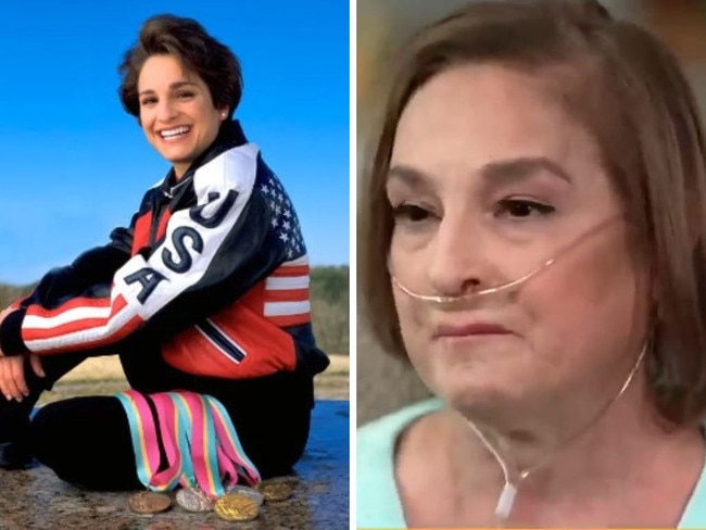 Olympics left iconic star damaged forever