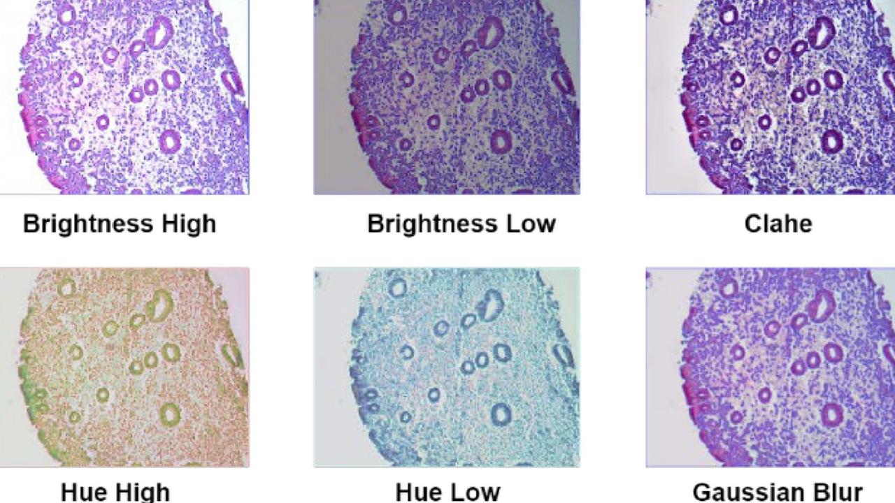 Photometric augmentation is applied to the data. Picture: CDU