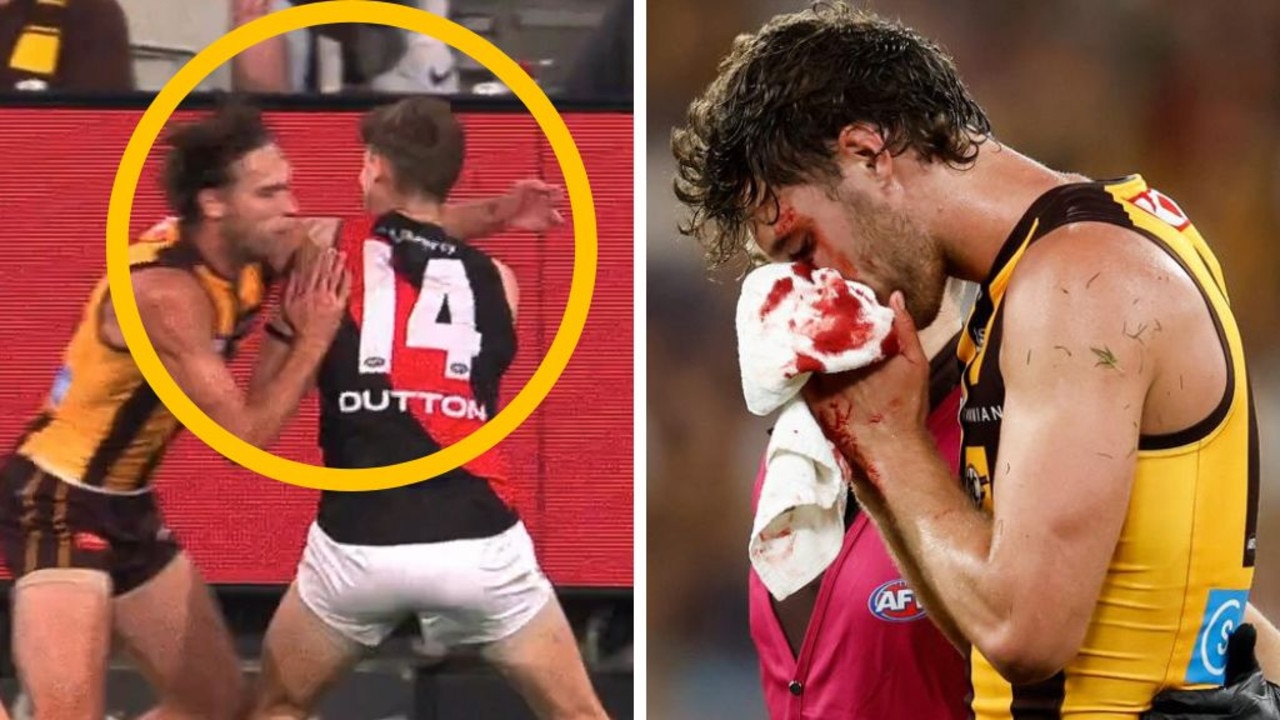 Footy world torn over shocking high shots