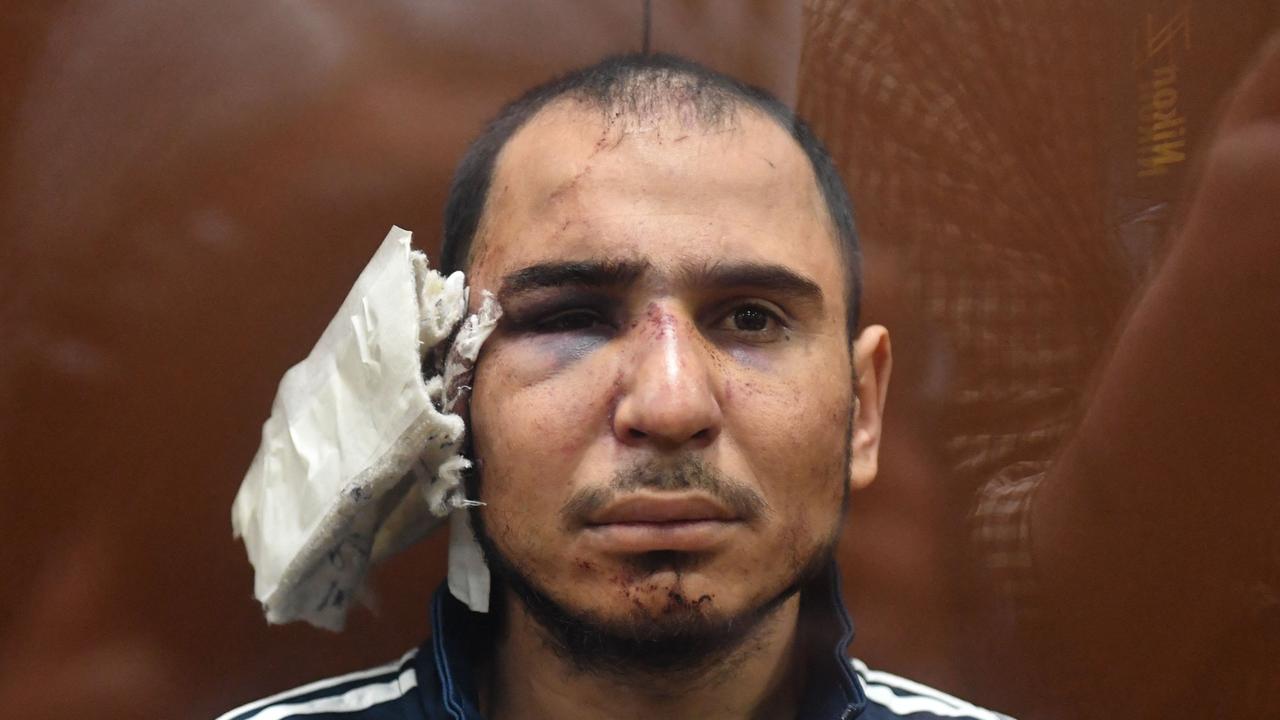 Rachabalizoda allegedly had his ear partially severed during his arrest. Picture: Olga MALTSEVA / AFP