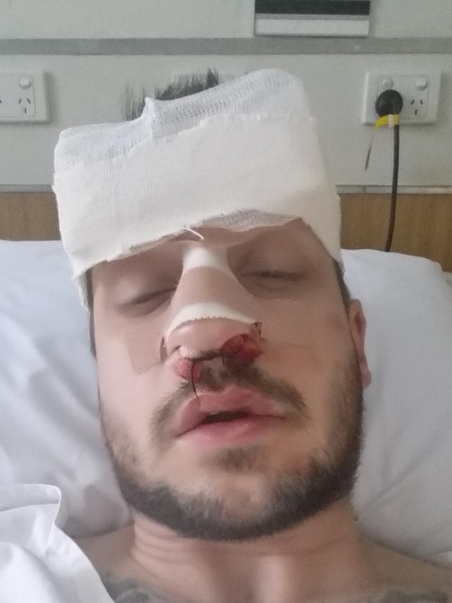 Sen-Constable Chris Eyre was bashed with a lump of wood after being called to a rowdy party.