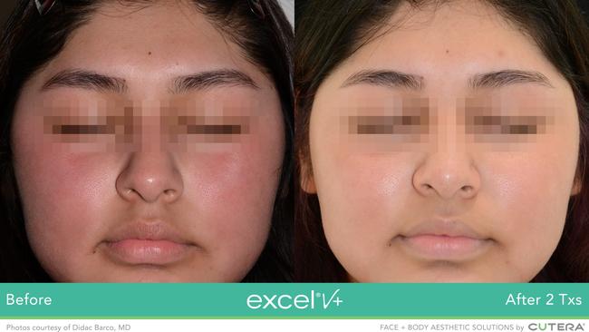 Another patient’s before and after shots.