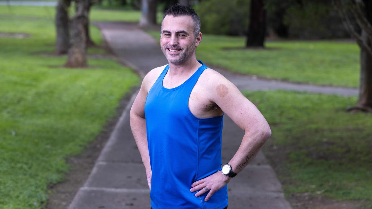 August 25, 2024: Kyle Collis is a 38-year-old cystic fibrosis sufferer about to run his 3rd ultra-marathon in light of a new treatment becoming available on the PBS for children aged two years and above in Australia this month. Picture: Kelly Barnes