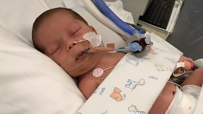 Charlie Quakawoot has a congenital heart disease called supraventricular tachycardia. The condition was picked up at 28 weeks, signalled by an elevated heart rate. He was born in Townsville and then taken to Queensland Children’s Hospital in Brisbane before returning to Mackay. Picture: Contributed