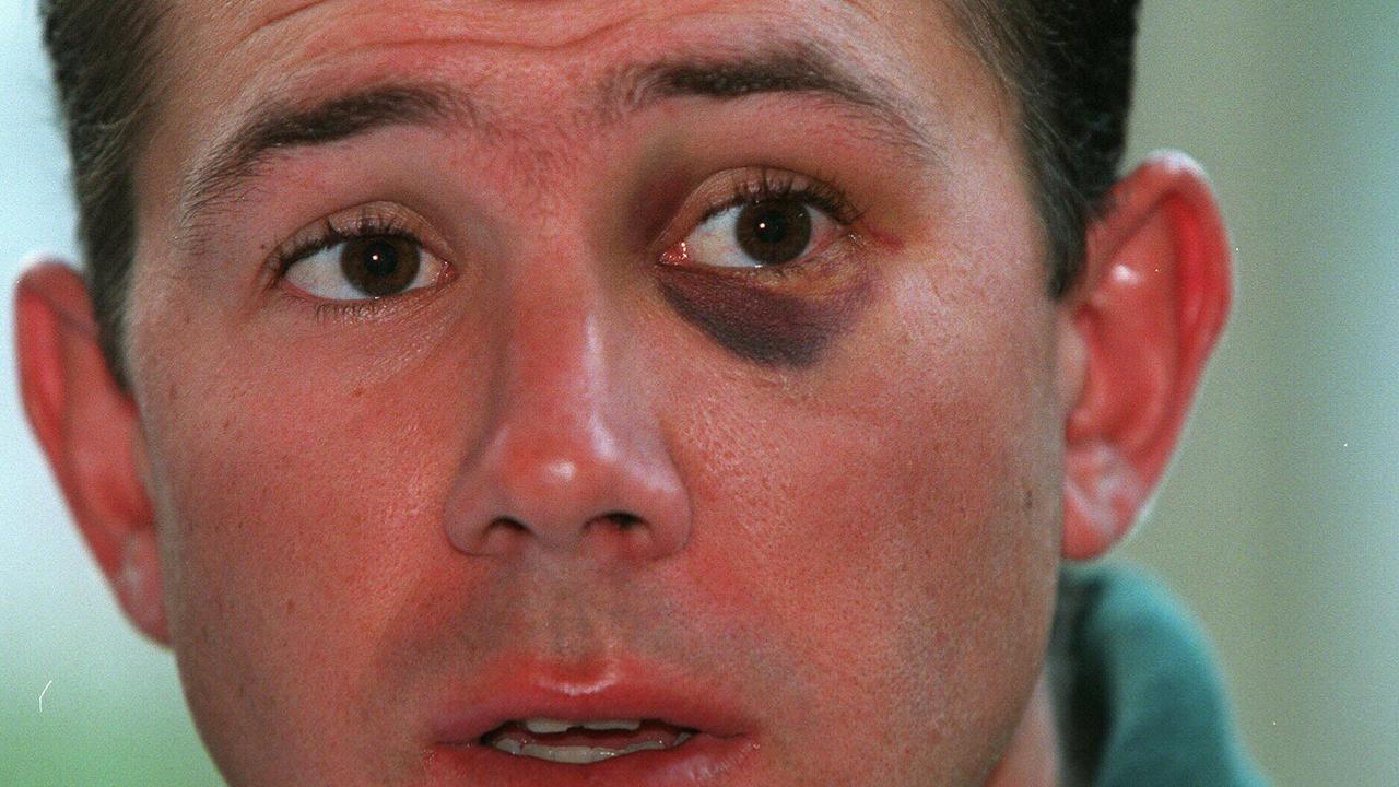 /hobart tas sport not cricket 20 jan 1999 Ricky Ponting suspended from the Australian team after being involved in a fight at the Bourbon & Beef Bar @ /Kings /Cross in /Sydney on 18/1/99 pic:phil/hillyard headshot black-eye & red ear injuries