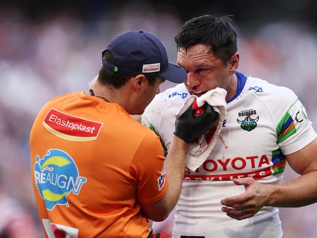 Raiders star Jordan Rapana suffered a fractured cheekbone in his final game for the club. Picture: Getty Images