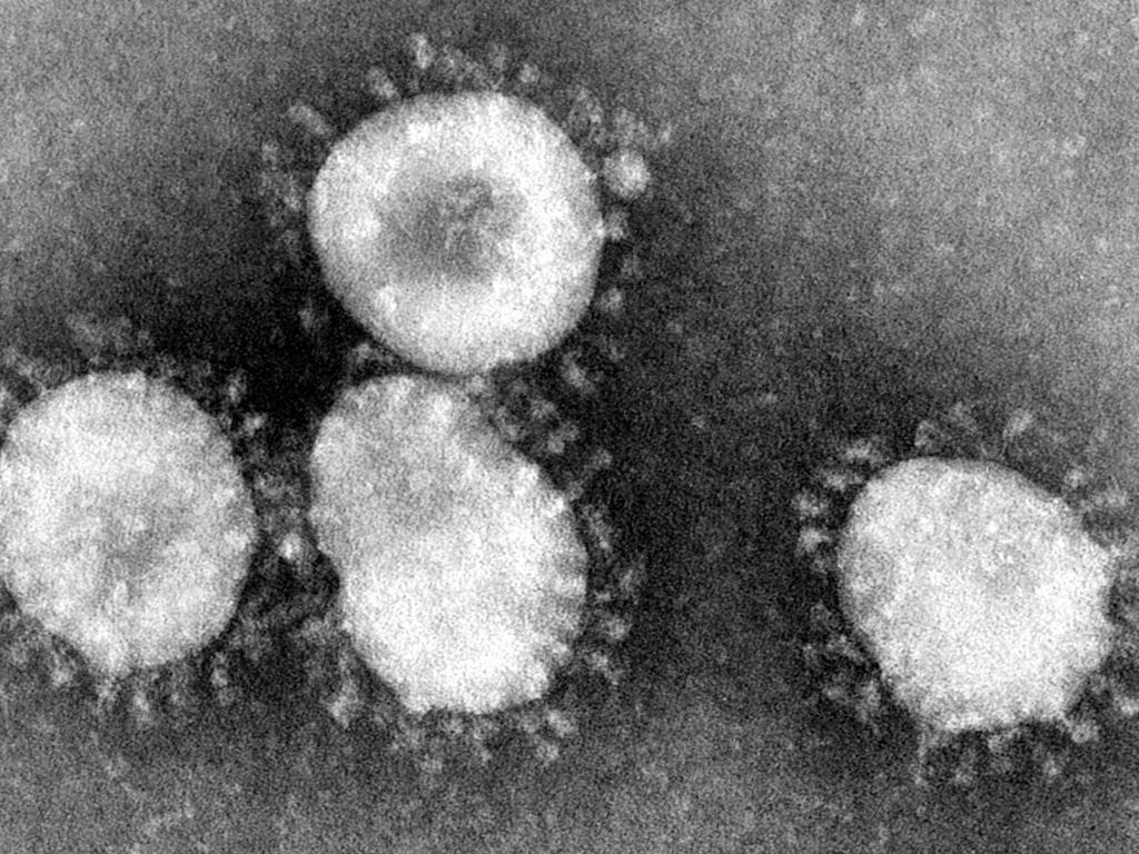 Under a microscope, these viruses resemble crowns or halos.