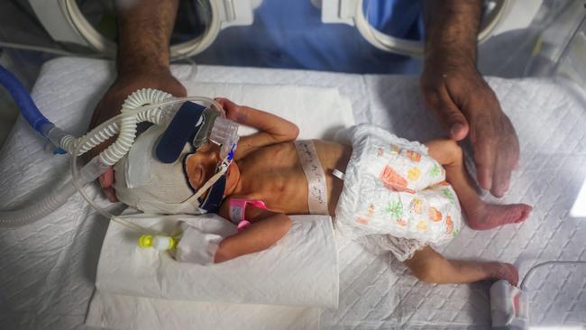 TOPSHOT - A medic cares for 'Sabreen al-Ruh al-Sheikh', a Palestinian baby delivered preterm by caesarian section minutes before the death of her mother, gravely injured in an Israeli air strike, at the Emirati hospital in Rafah in the southern Gaza Strip on April 24, 2024, amid the ongoing conflict between Israel and the Hamas movement. (Photo by AFP)